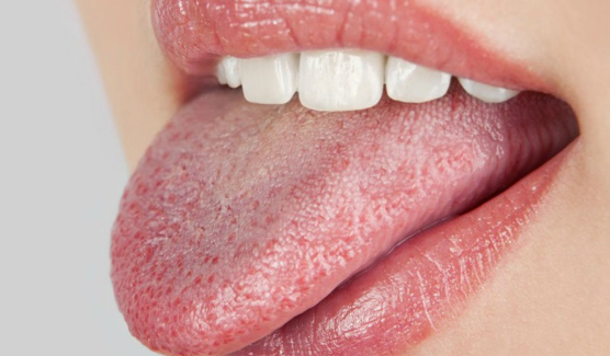 Dry Mouth at Night Causes, Diabetes, Treatment, Home Remedies